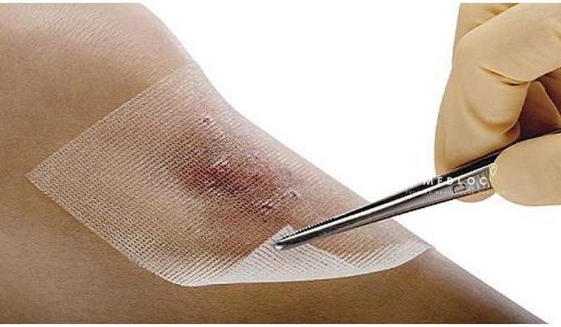 Debridement and Biologic Dressings
