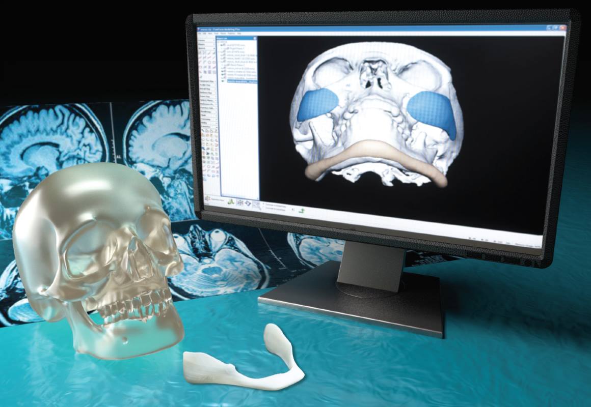 Virtual Surgical Planning