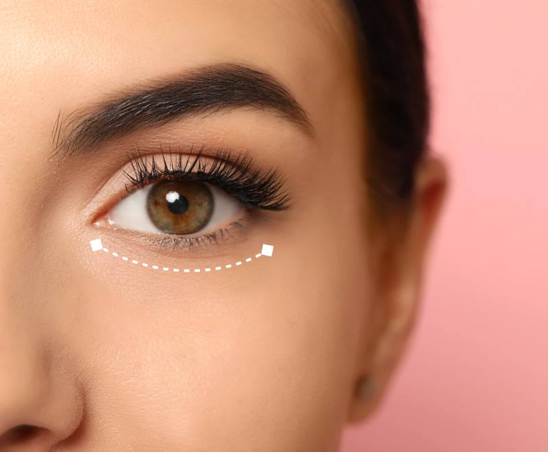 Plastic Surgery Precision