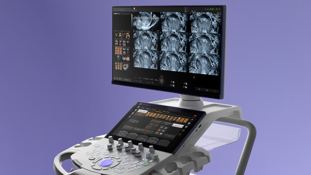 GE Voluson Fetal Ultrasound